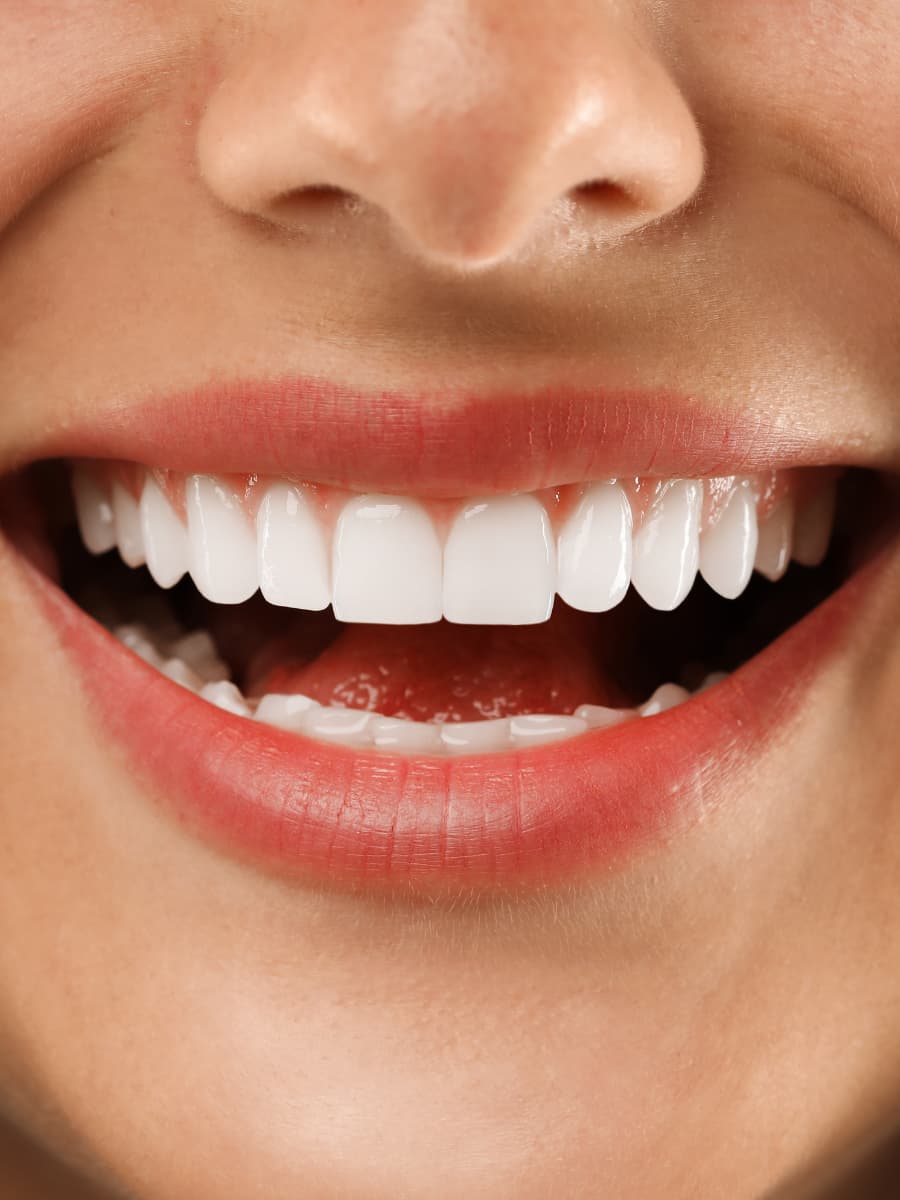 Inicio diseño de sonrisa 1200x 900